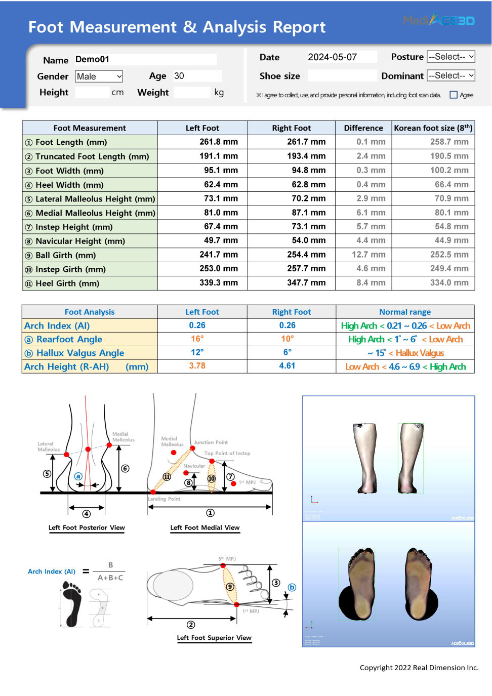 Foot Report